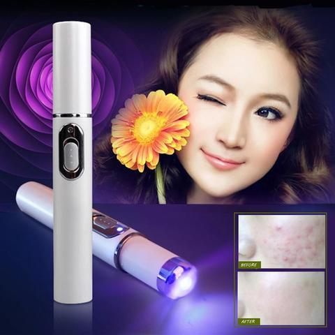 Blue Light Acne Laser Pen for Scar & Wrinkle Removal